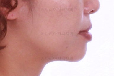 부산연산동교정치과