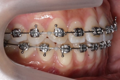 부산연산동청소년교정