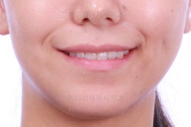 부산교정잘하는치과