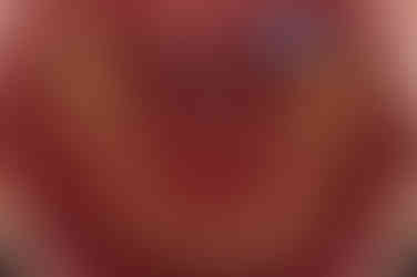 부산연산동사랑니발치