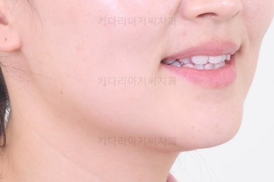 연산동교정치과