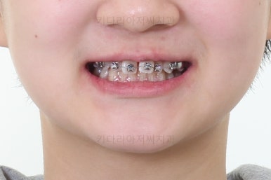 부산청소년교정치과