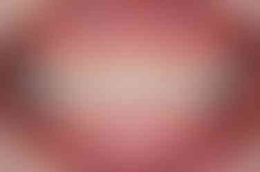 부산치아교정잘하는곳