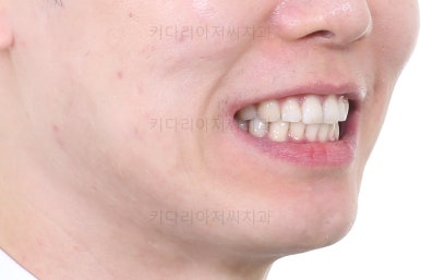 부산교정치과