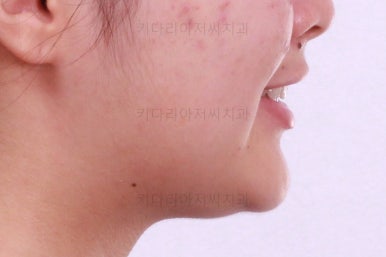 부산치아교정치과