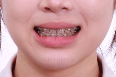 부산치과
