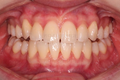 부산교정전문의