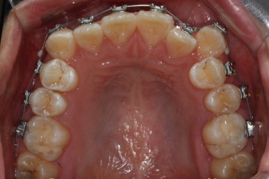 부산교정전문의