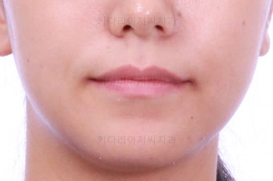 부산교정잘하는치과