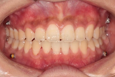 부산치아교정치과