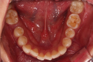 연산동교정치과