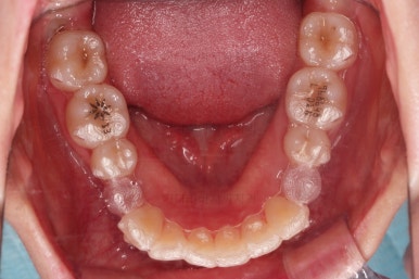 부산교정전문의
