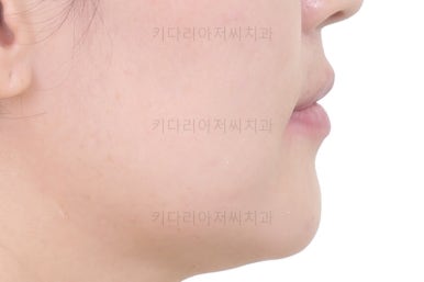 연산동교정치과