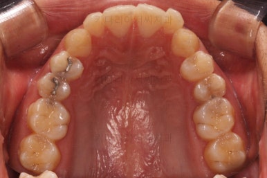 부산연제구교정