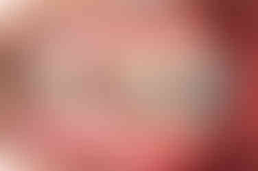 부산치아교정전문의