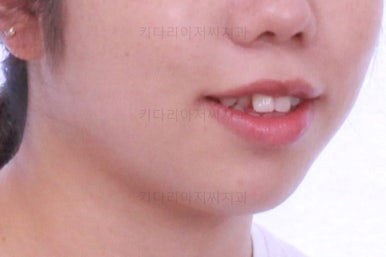 부산교정전문치과