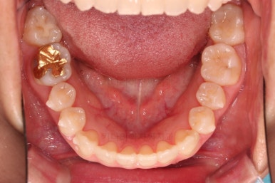 부산인비절라인