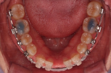 부산교정치과추천