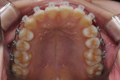 연산동교정치과