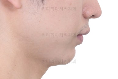 부산연제구교정