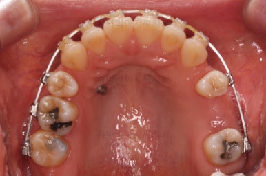 부산재교정치과