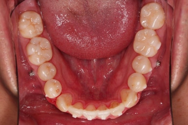 부산인비절라인