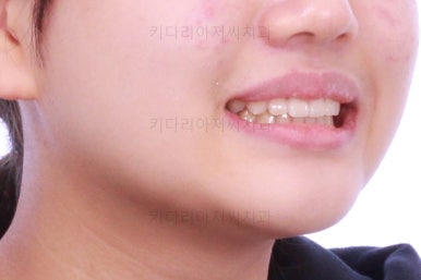 부산교정전문의