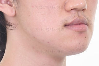 부산군인교정