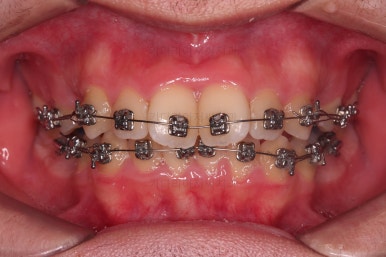 부산교정치과추천