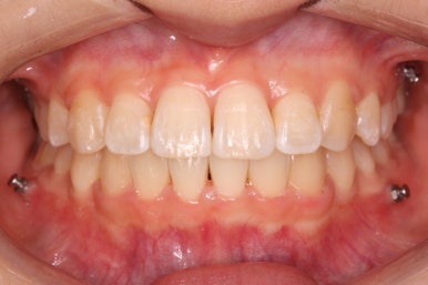 연산동교정치과