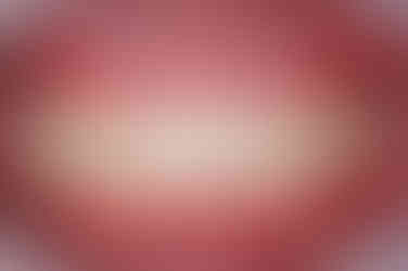 부산왜소치교정