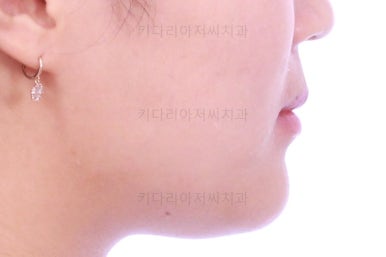 부산치아교정치과