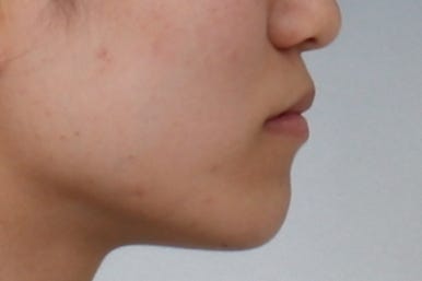 부산교정전문의