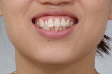 부산교정치과추천