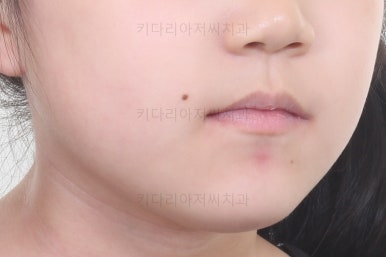 부산초등학생교정