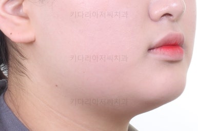 부산교정치과추천