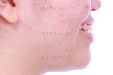 부산치아교정치과