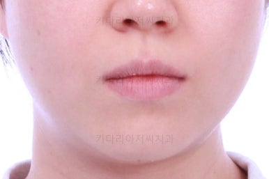 부산치아교정잘하는곳