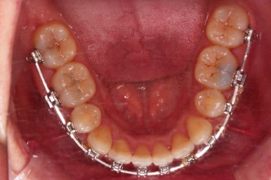 연산동교정치과