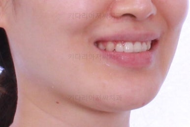 부산교정치과