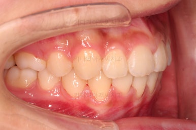 부산치아교정치과