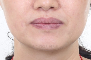 부산치아교정잘하는곳