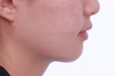 동래구치아교정