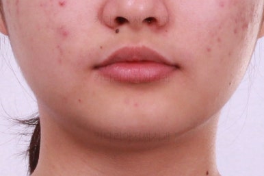 부산치아교정치과