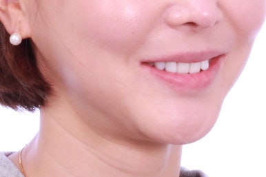 연산동부분교정