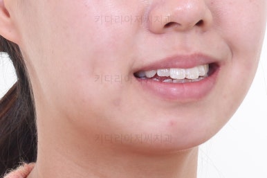 부산치아교정잘하는치과