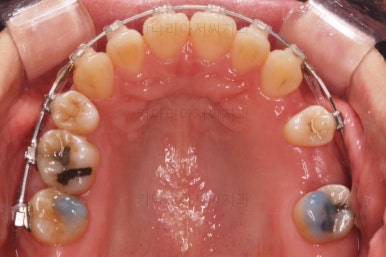 부산재교정치과