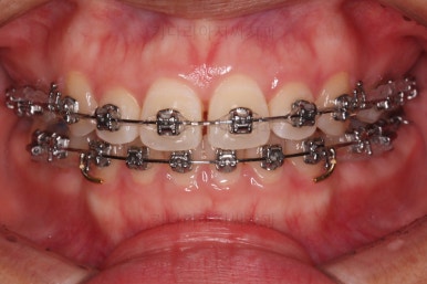 사직동교정치과