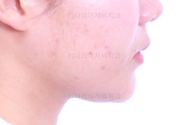 부산치아교정치과