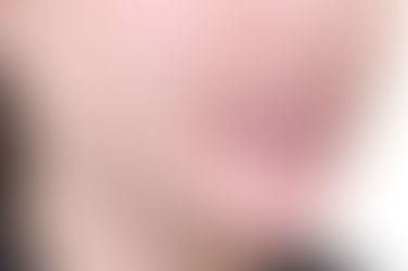 부산개방교합